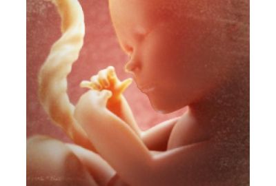 Pregnancy Week 32