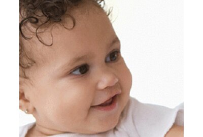 Cow Milk Allergy in Baby